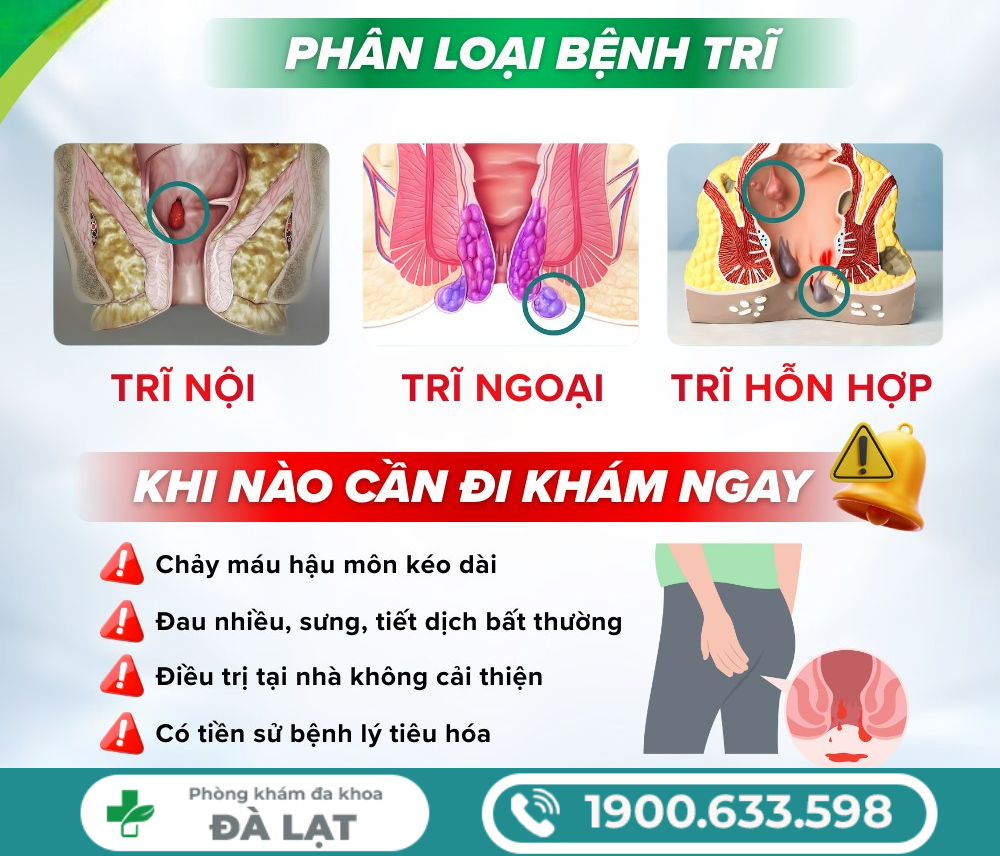 Hình ảnh minh họa